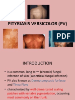 Pityriasis Versicolor Part 1