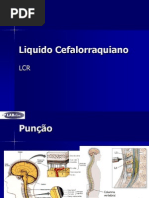 Liquido Cefalorraquiano