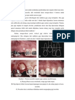 A, Ruang Dibuat Secara Ortodontik, Tetapi Gigi Tidak Erupsi. B, Gigi Diposisi Labial, Korona Kepersimpangan Mucogingival, Ada Cukup Gingiva Di Area