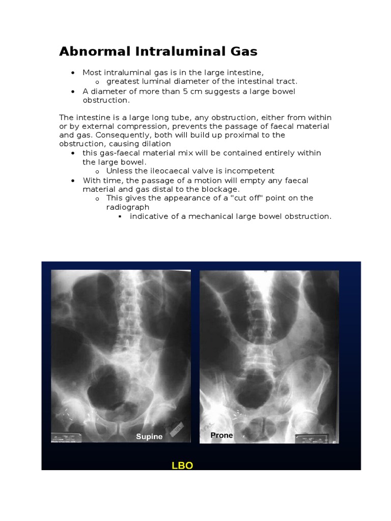 Abnormal Intraluminal Gas Gastrointestinal Tract Gastroenterology
