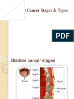 Bladder Cancer Stages and Types