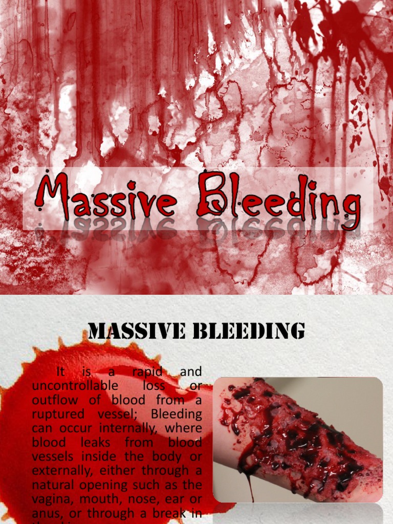 Managing Massive Hemorrhage in Trauma | PDF | Bleeding | Blood Vessel