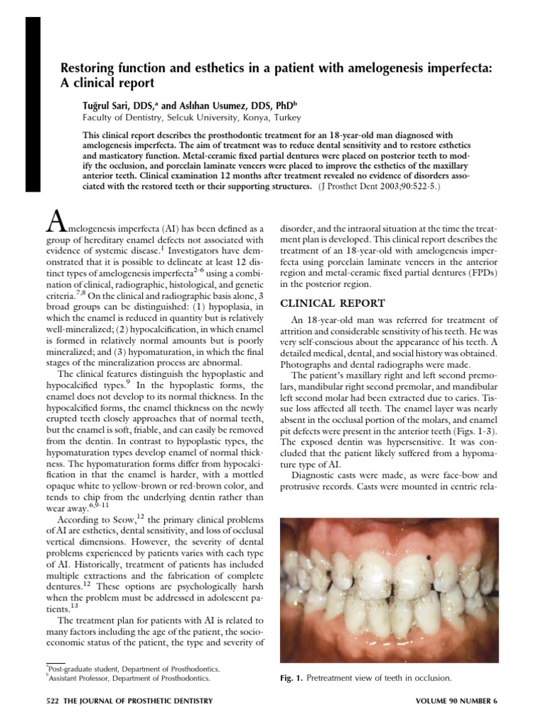 Clinical Report Tooth Enamel Dentures