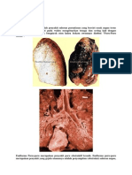 Emfisema Paru