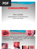 coagulopatias