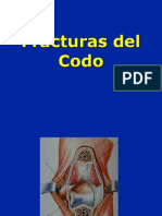 09-fracturasdelcodo-100810052207-phpapp02