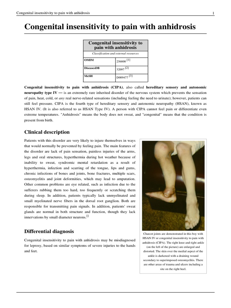 Wikipedia - Congenital Insensitivity To Pain With Anhidrosis | PDF ...