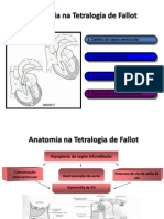 Anatomia Na Tetralogia de Fallot