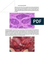 KarsinoidApendiksTumorJarangMetastasis