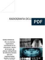 Radiografia Oclusalmiki