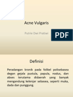 Acne Vulgaris