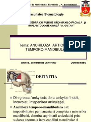 anchiloza atm Arhive - Stomatologie