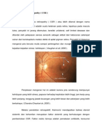 Central Serous Retinopathy