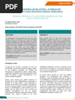 Tratamiendo de Torus Mandibular Para PPR