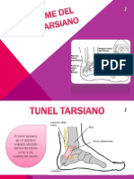 Sindrome Del Tunel Tarsiano