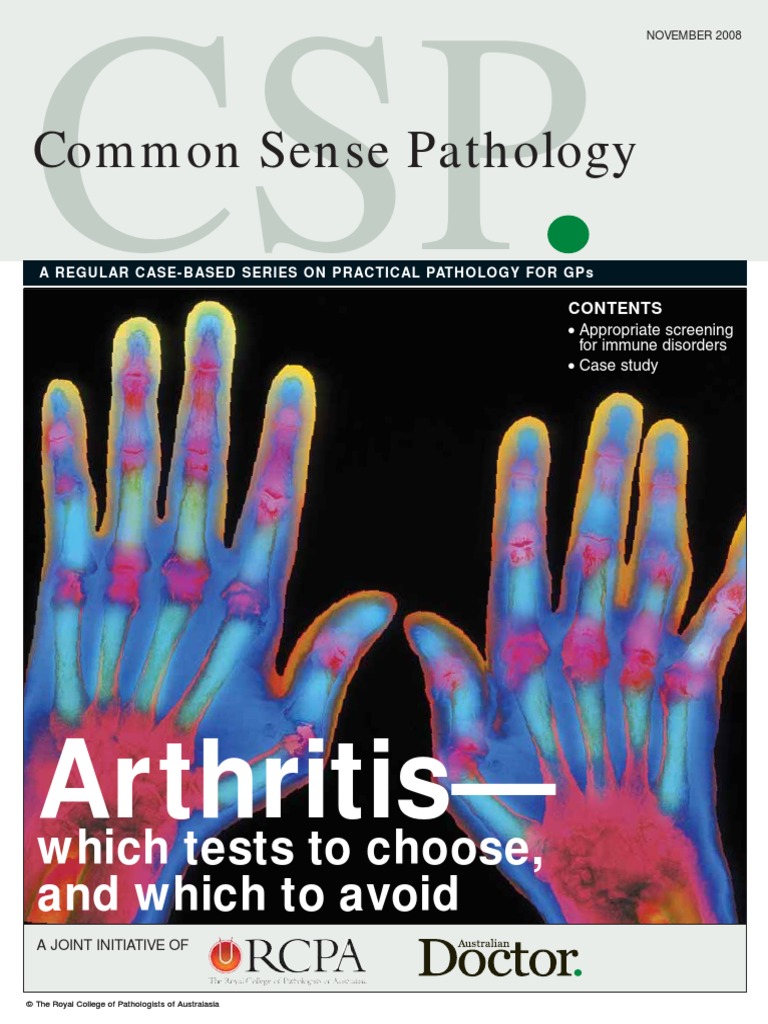 Arthritis Which Tests to Choose, And Which to Avoid Nov08 Systemic