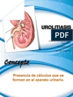 UROLITIASIS