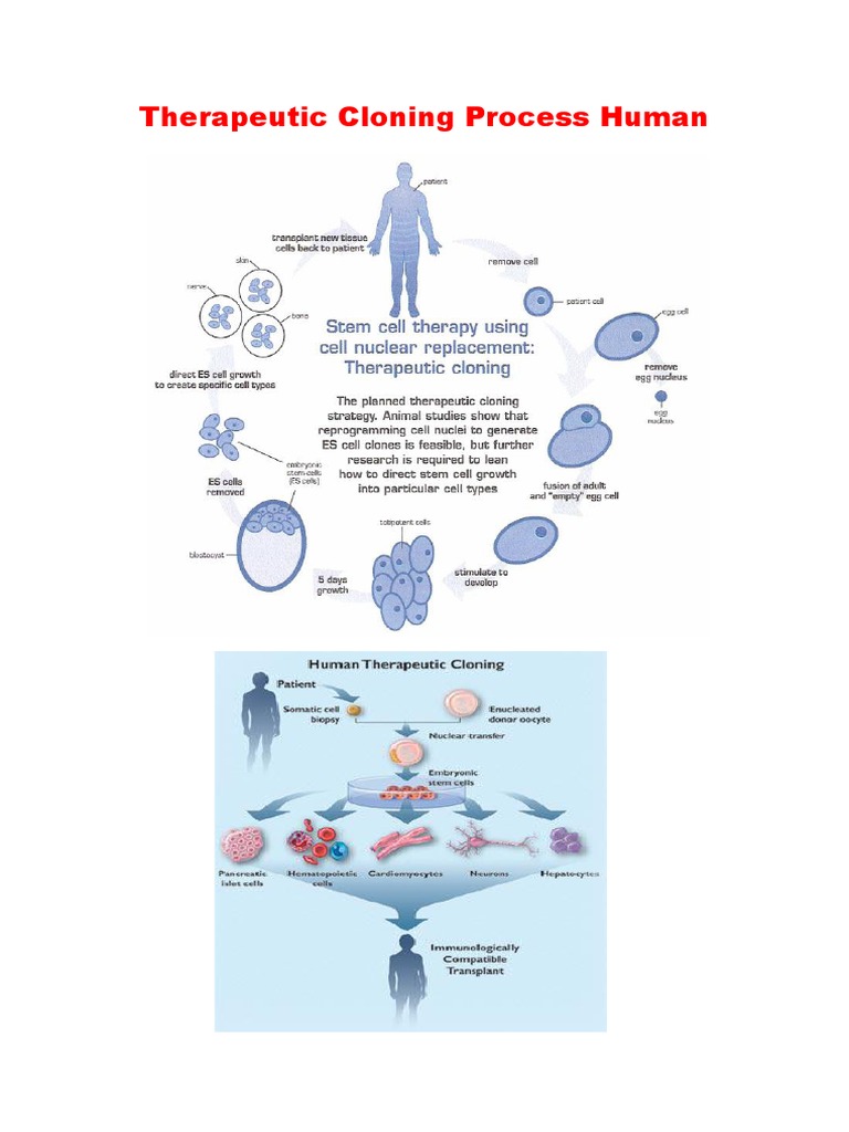 Therapeutic Cloning Process PDF