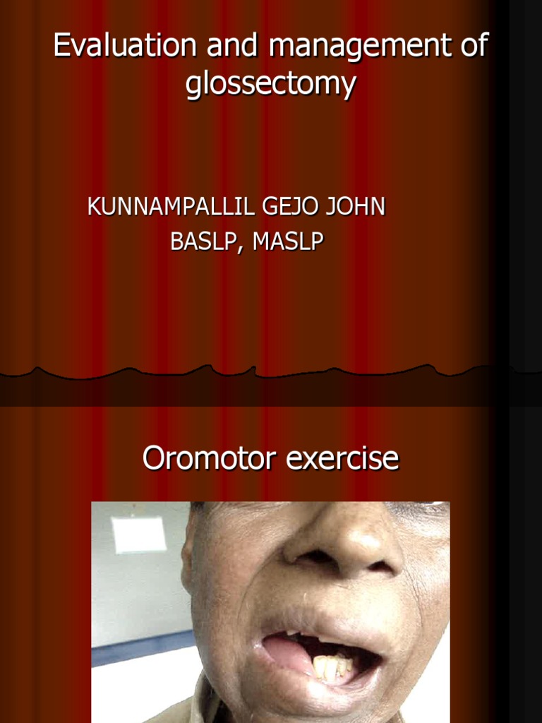 Evaluation and Management of Glossectomy Clinical Medicine Medical