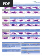 Sysmex KX 21 Histogram Interpretation Handbook | PDF | Anemia | White ...