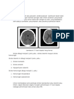 Serebrovaskuler Radiologi