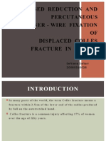 Closed Reduction and Percutaneous Kirschner - Wire Fixation OF Displaced Colles Fracture in Adults