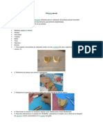 Prótesis Parciales 37 Pasos