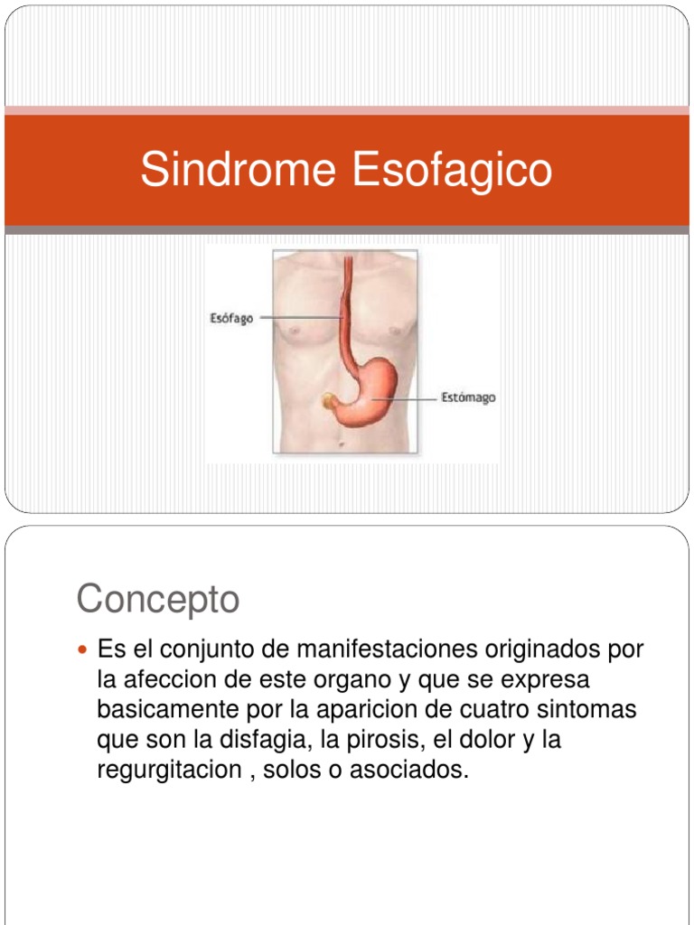 Síndrome Esofágico: Síntomas y Causas | PDF