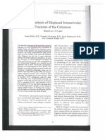 Osteosynthesis of Displaced Intra-Articular Calcaneal Fractures