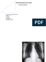 Estudio Radiografico de Torax