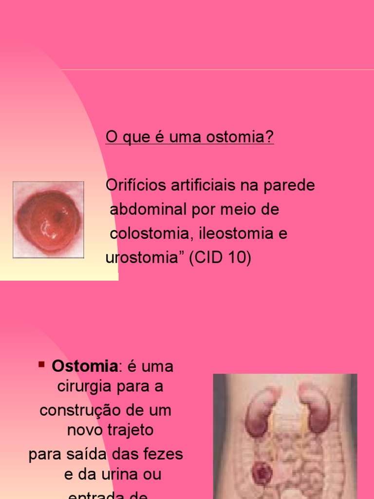 Ostomias (AULA)