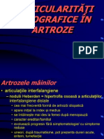 Artroze