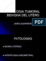 Patologia Tumoral Benigna Del Utero