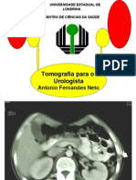 Tomografia para o Urologista