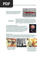 Esvaziamento Do Endodonto