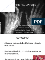 Artritis Reumatoide