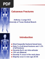 Download Calcaneus Fracture by mohdk2002 SN17654779 doc pdf