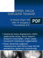 Gelişimsel Kalca Displazisi Tedavisi