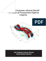 Visión por computador utilizando MATLAB y el Toolbox de PDI