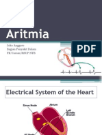 Aritmia