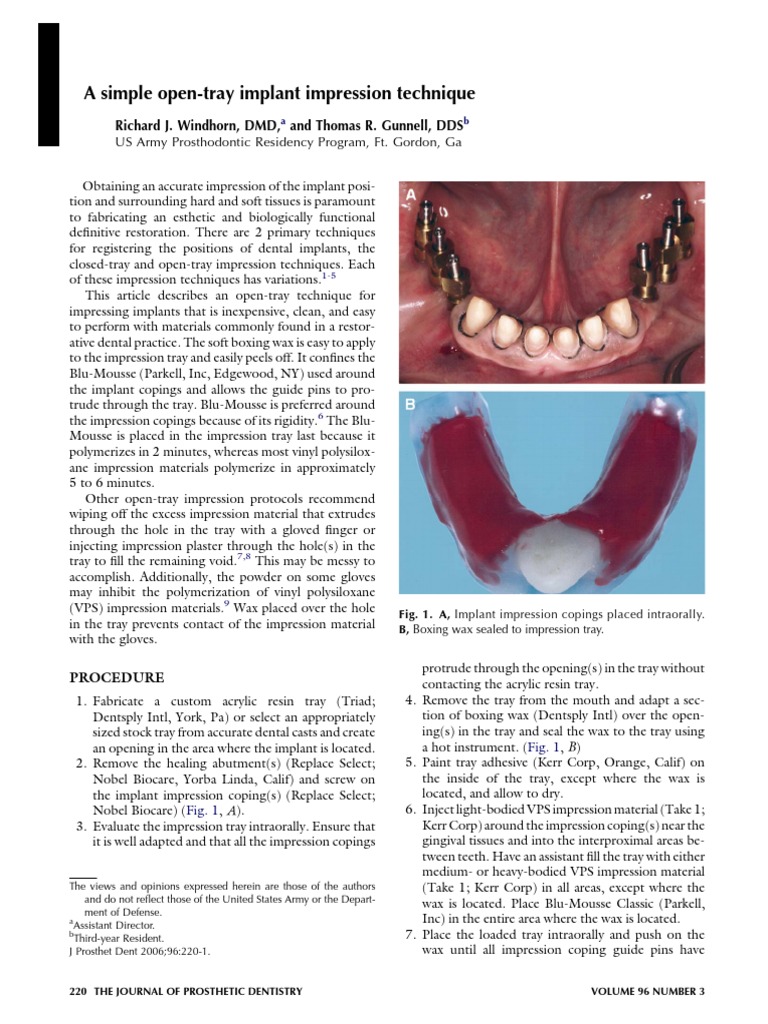 Open Tray Impression Technique Dental Implant Dentistry Branches