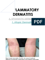 1. Atopic Dermatitis