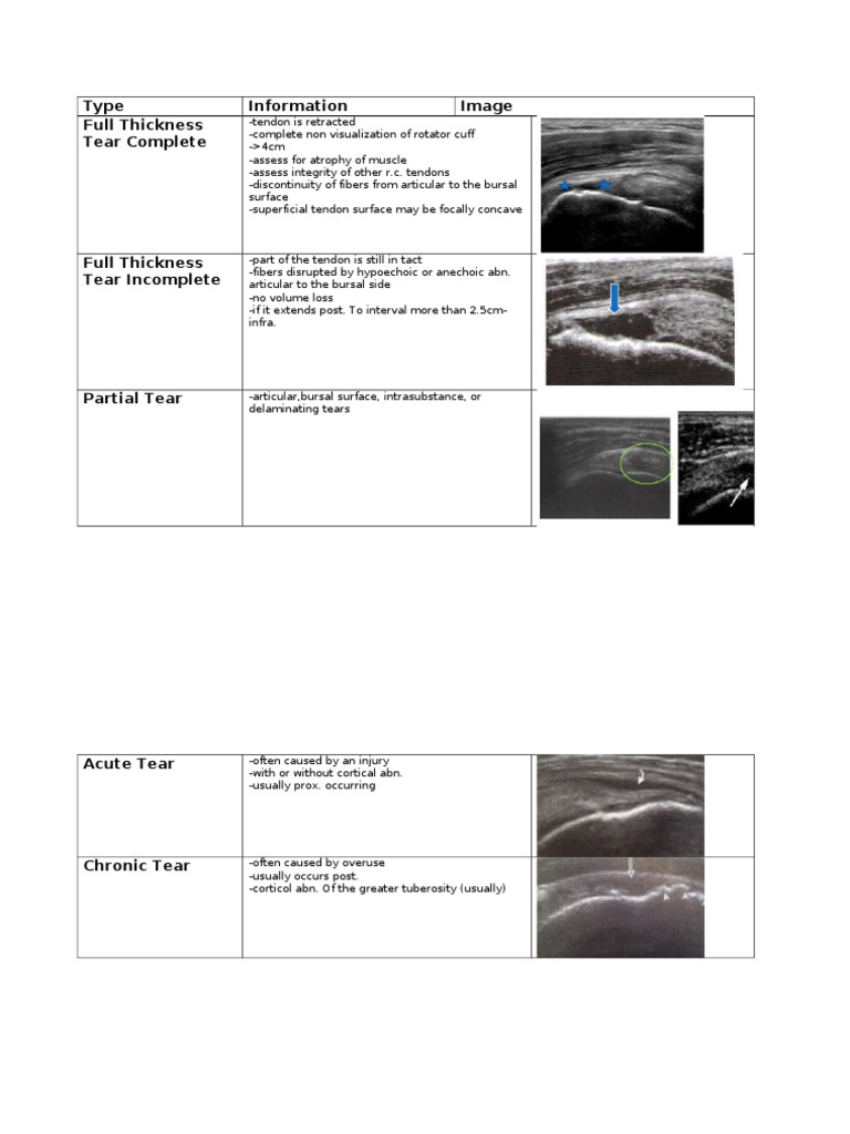 Types of Rotator Cuff Tears Explained | PDF | Wellness