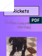 Rickets