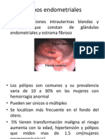 Pólipos Endometriales