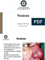 Rosácea Ocular