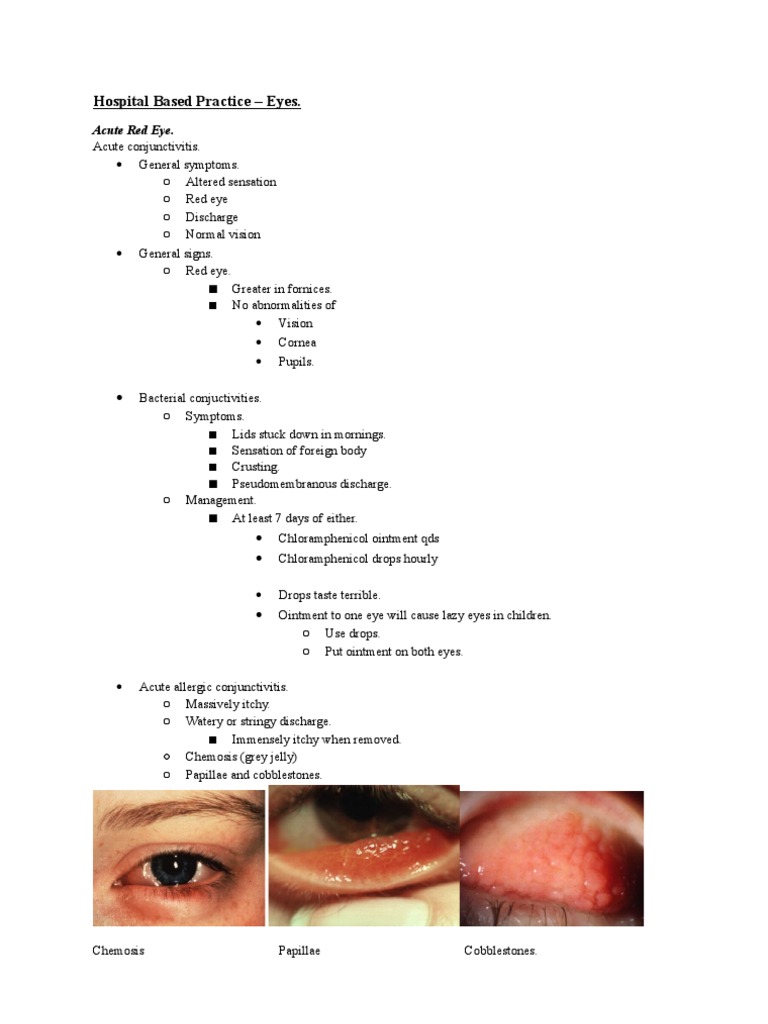 Causes of Red Eye For Medical Finals (Based On Newcastle University