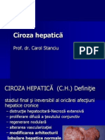 Ciroza Hepatică