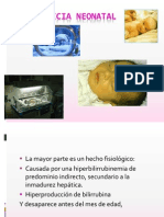 Ictericia Neonatal