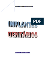 Implantes Dentários (Manual)